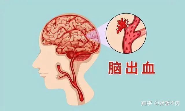 高血压的危害你注意了吗？